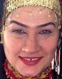 تغییر چهره خانم بازیگر همه را شوکه کرد